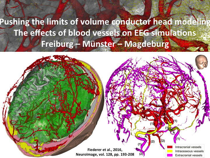 Article accepted for publication: NeuroImage